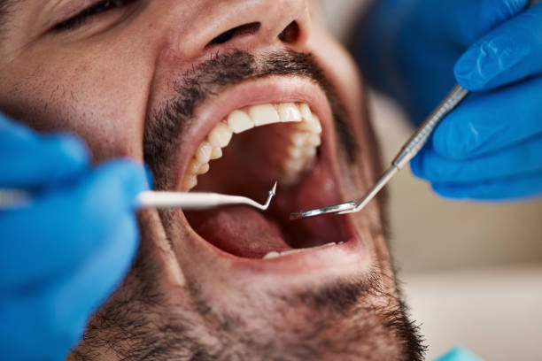 Best Weekend Emergency Dentist in Farmersville, TX