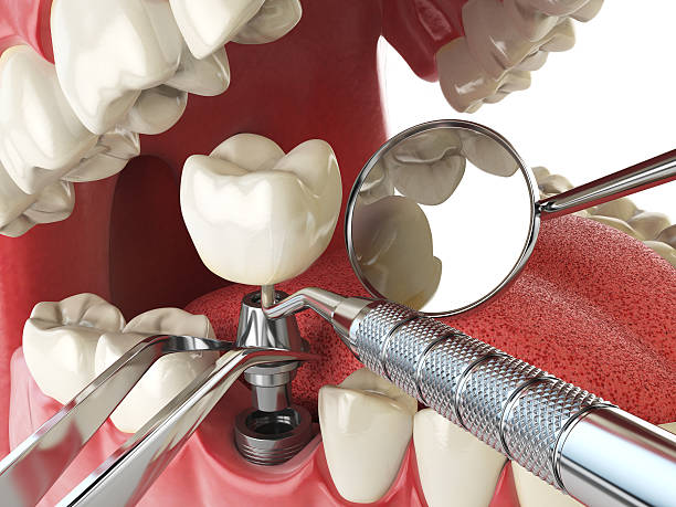 Best Emergency Treatment for Toothache in Farmersville, TX